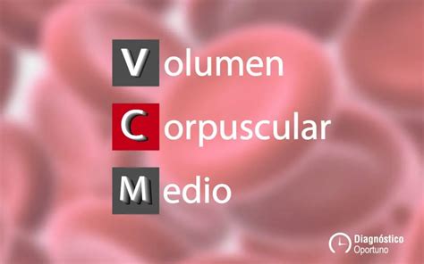 VCM .